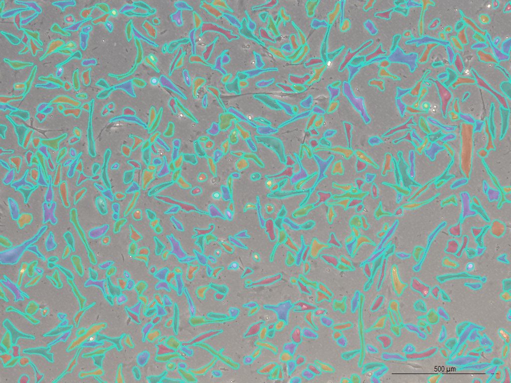 Adherent cell image with segmentation outlines