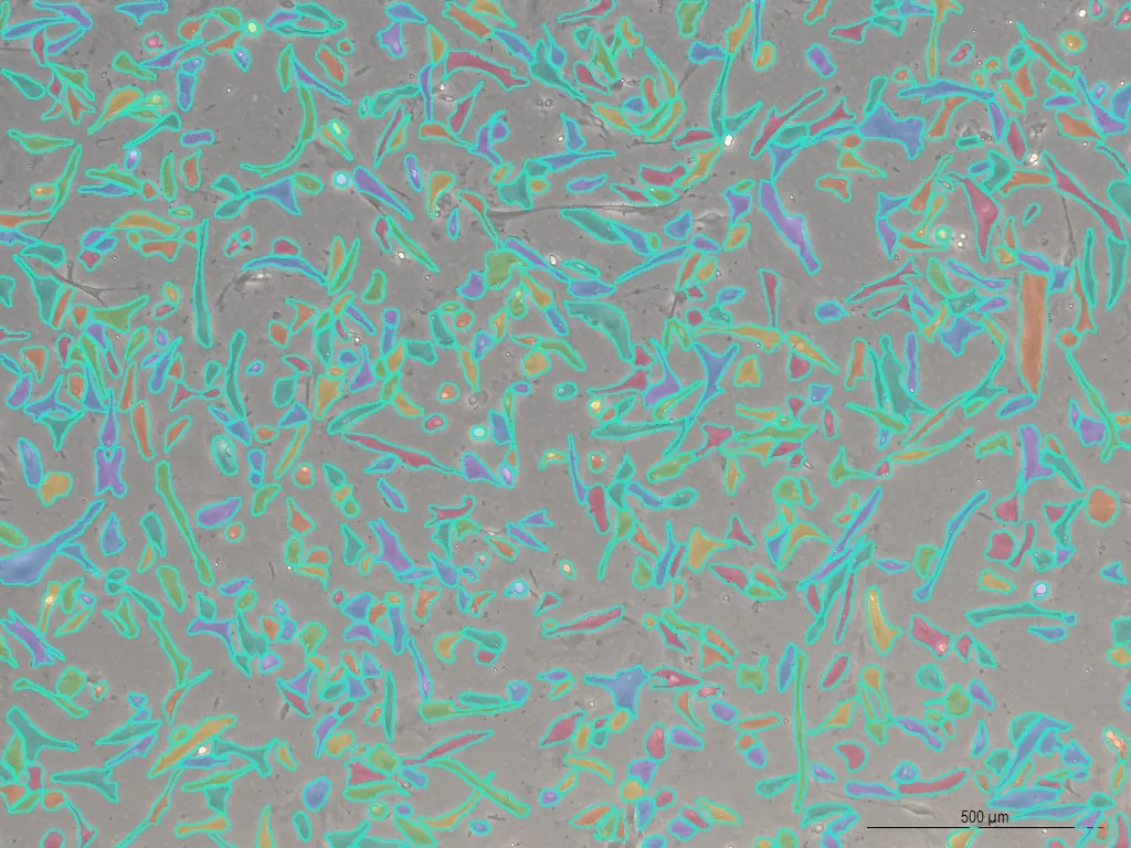 CellOpsis segmentation preview with adherent cells highlighted