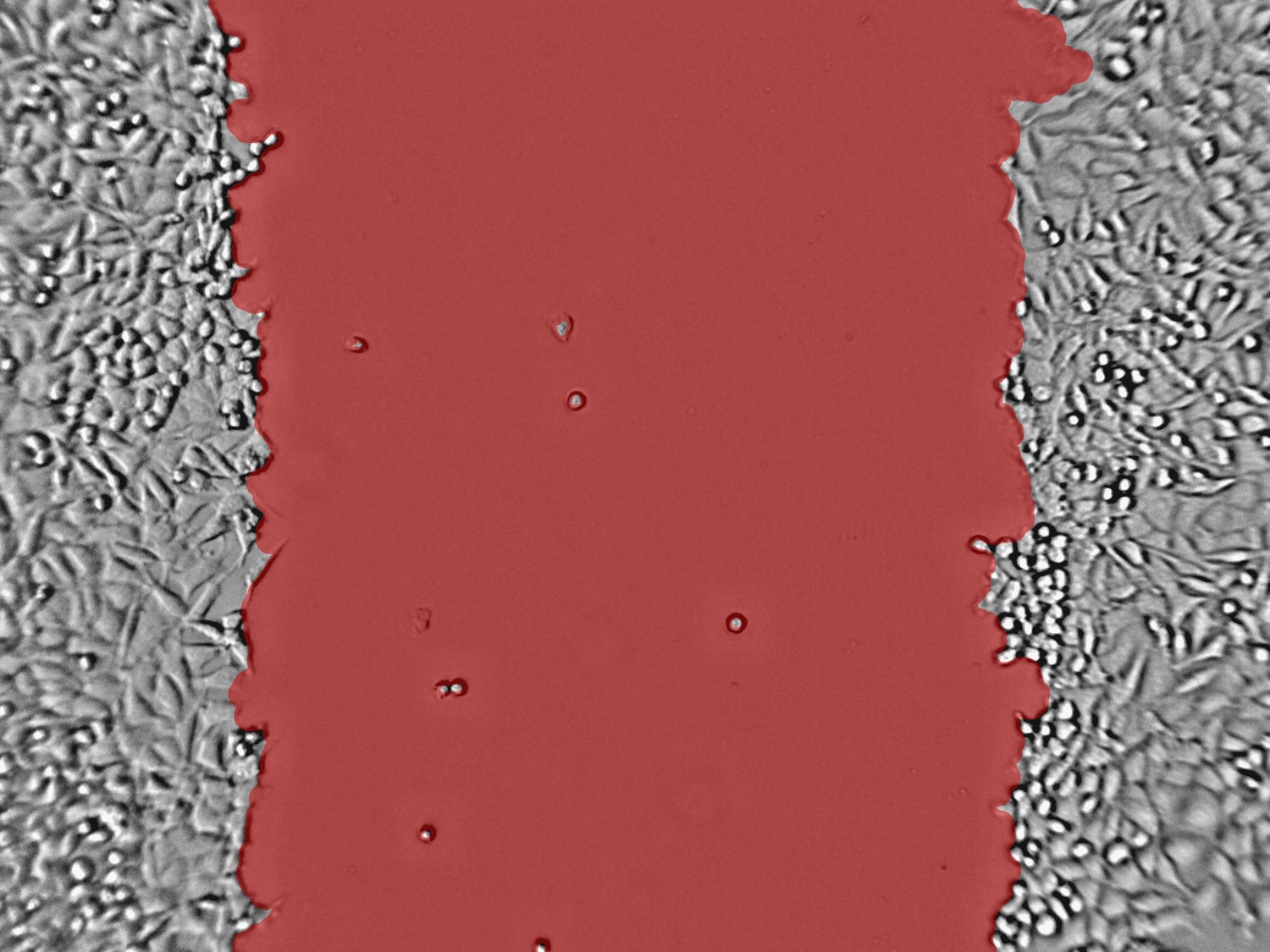 Scratch assay image with segmentation overlay