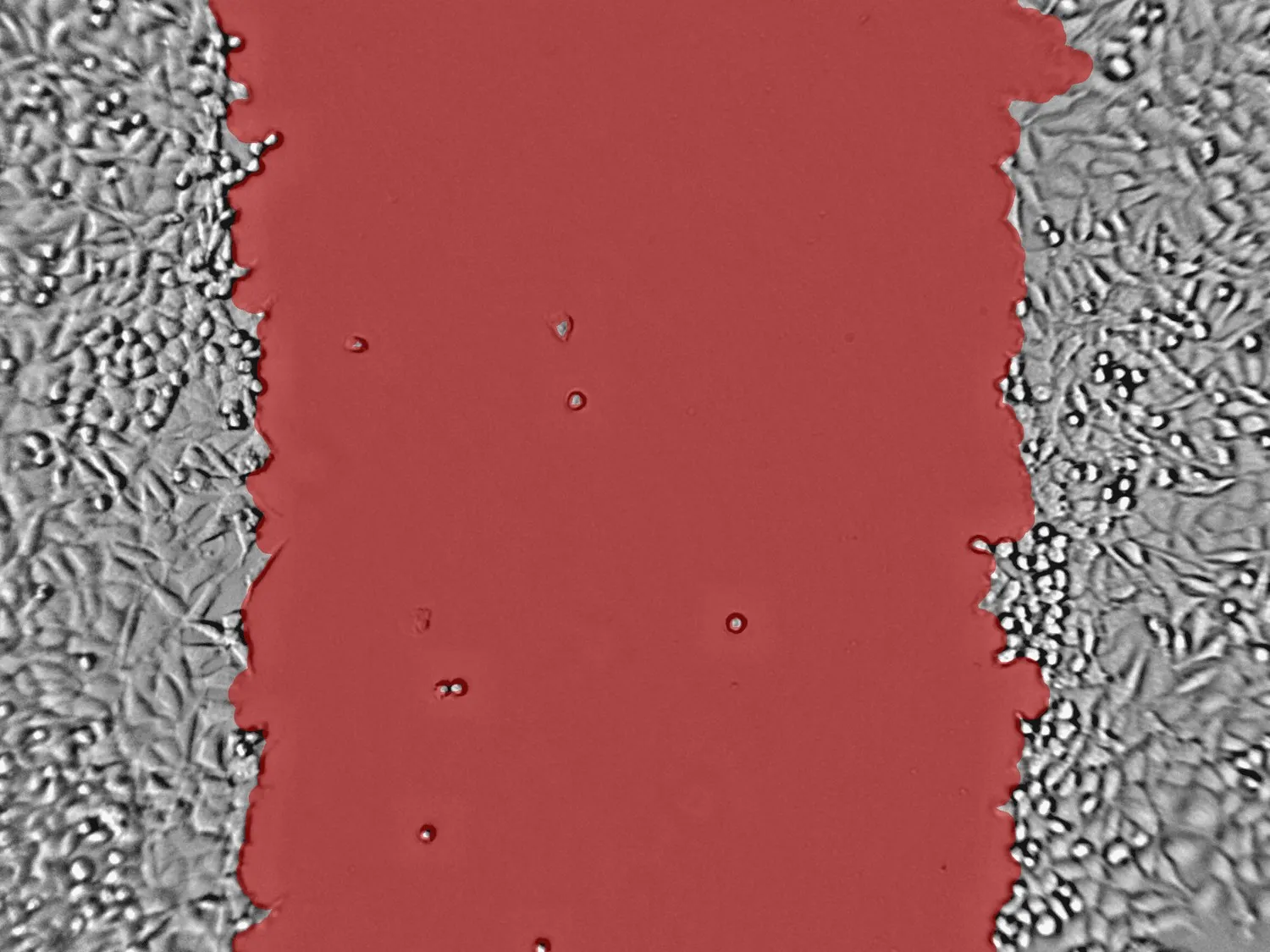 Scratch assay image with segmentation overlay