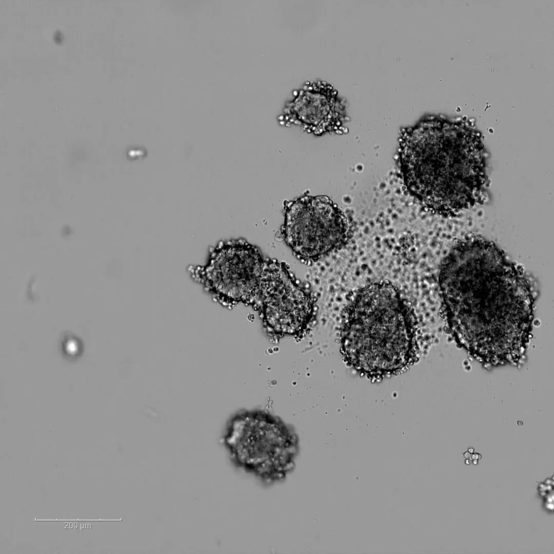 Raw spheroid microscopy image