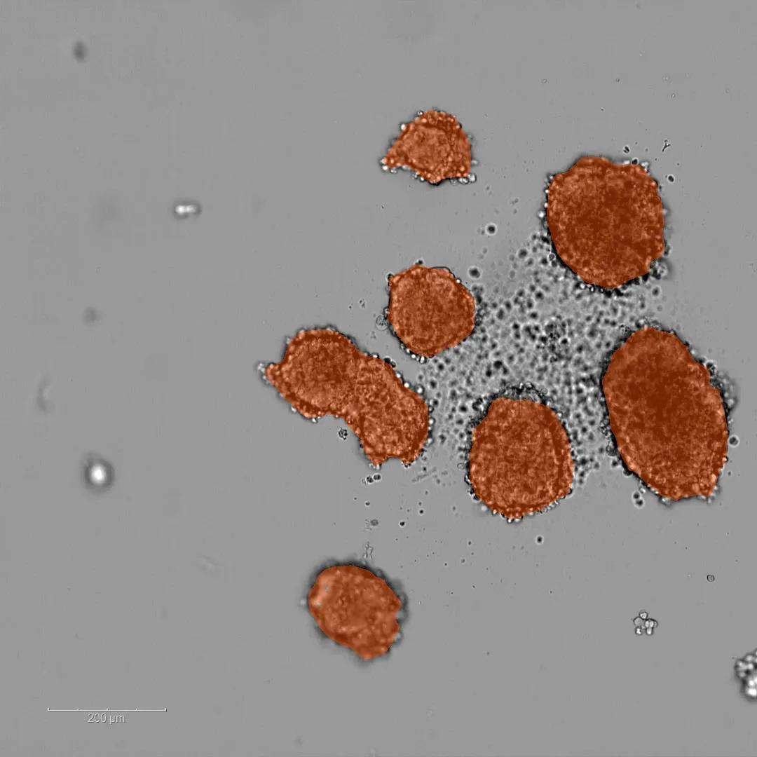Spheroid image with segmentation overlay