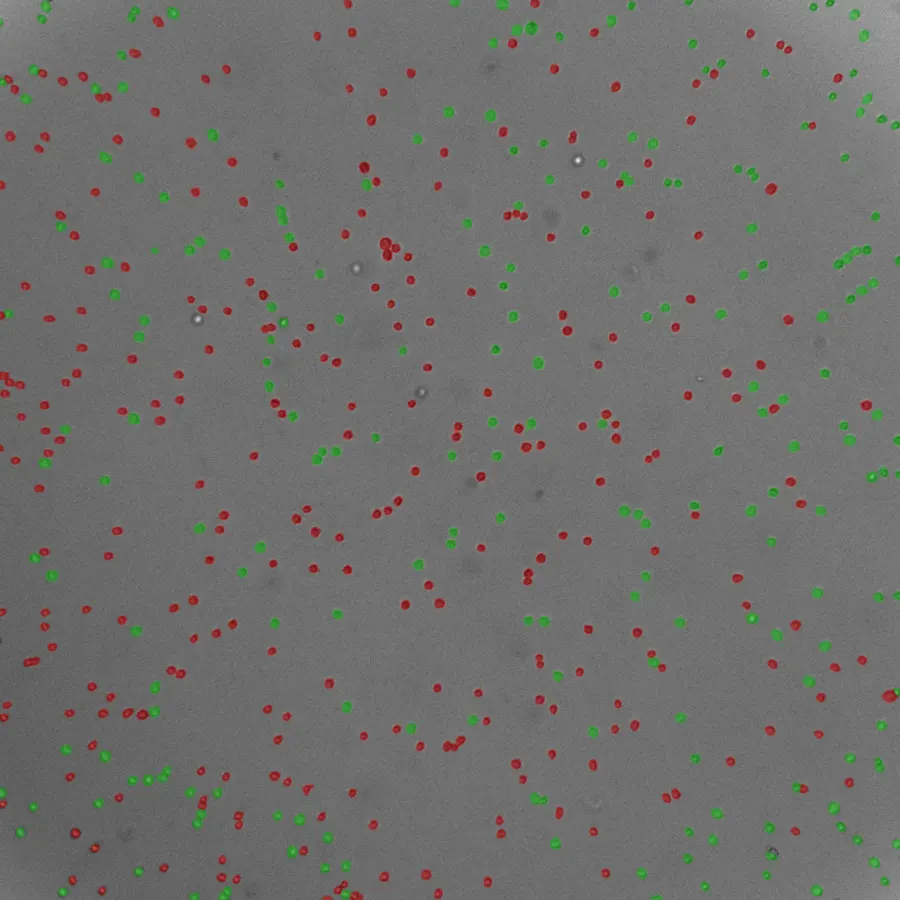 Suspension cell image with segmentation overlay