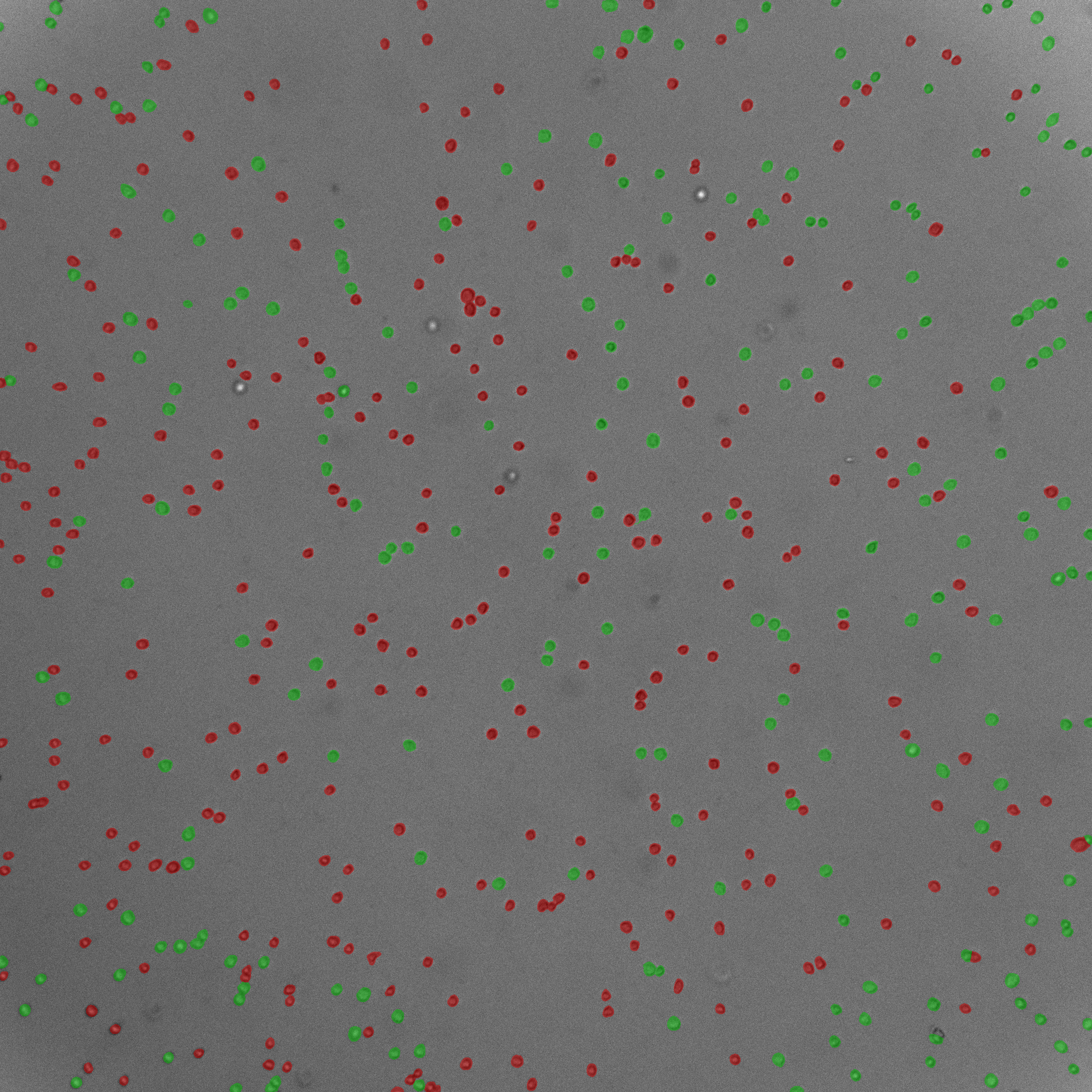 Suspension cell image with segmentation overlay