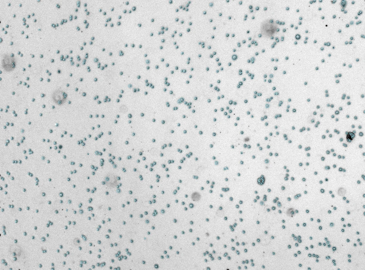 Cell mask overlay on the microfluidic plate image