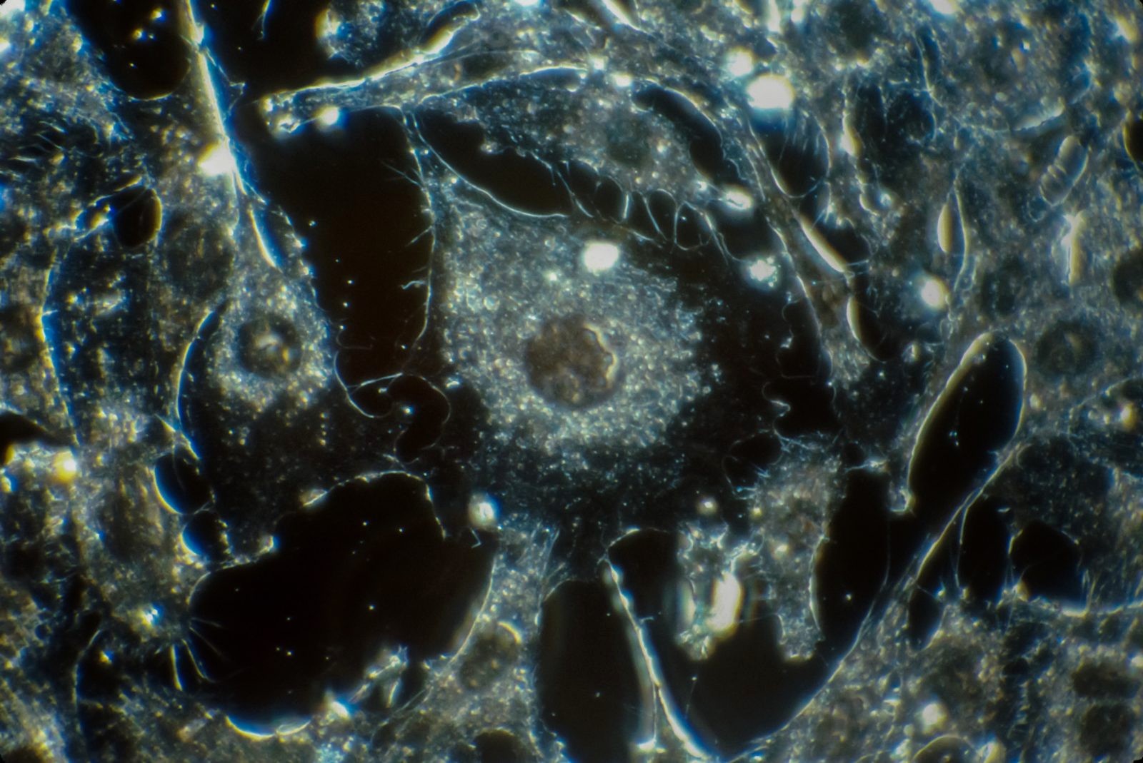 Microscopy image of a large cell prepared for segmentation
